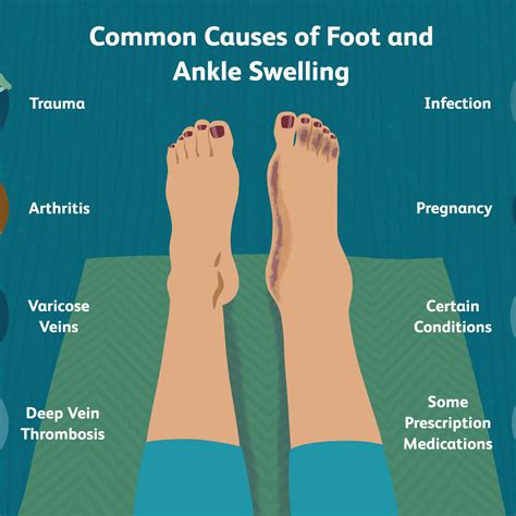 What Cause Swelling In Your Feet